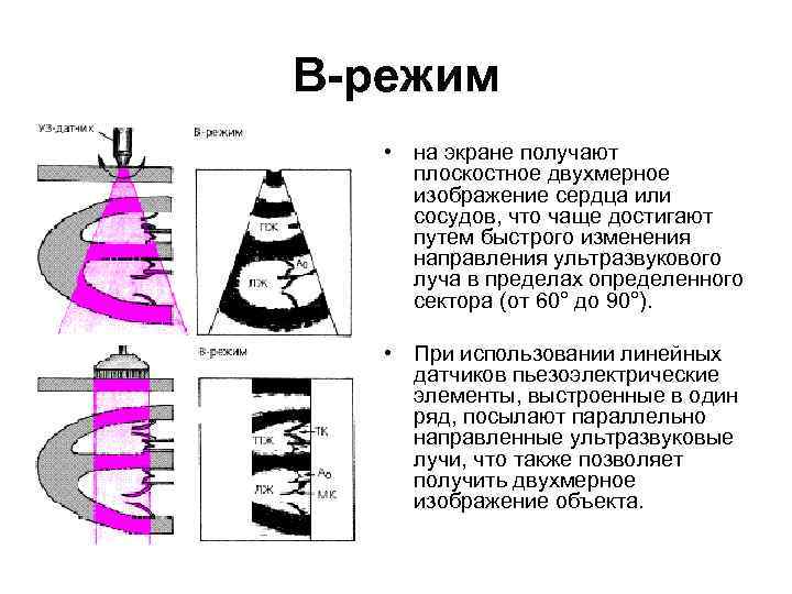 В-режим • на экране получают плоскостное двухмерное изображение сердца или сосудов, что чаще достигают