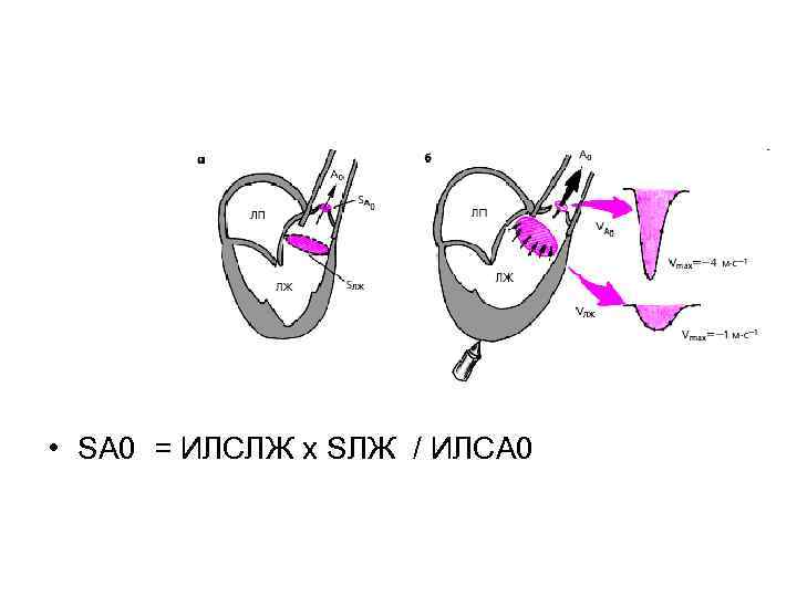  • SА 0 = ИЛСЛЖ х SЛЖ / ИЛСА 0 