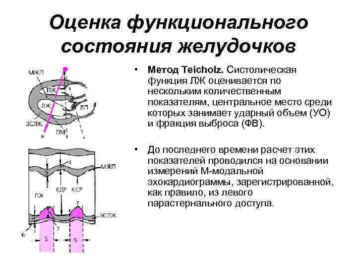 Оценка функционального состояния желудочков • Метод Teicholz. Систолическая функция ЛЖ оценивается по нескольким количественным