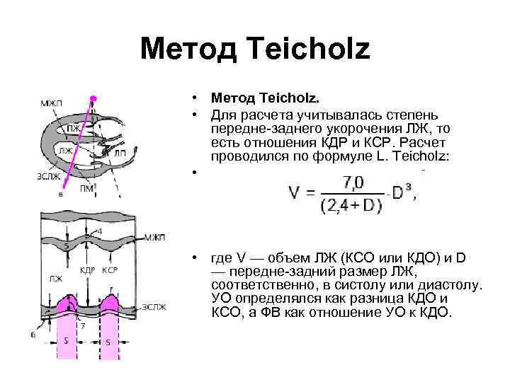 Метод Teicholz • Метод Teicholz. • Для расчета учитывалась степень передне-заднего укорочения ЛЖ, то