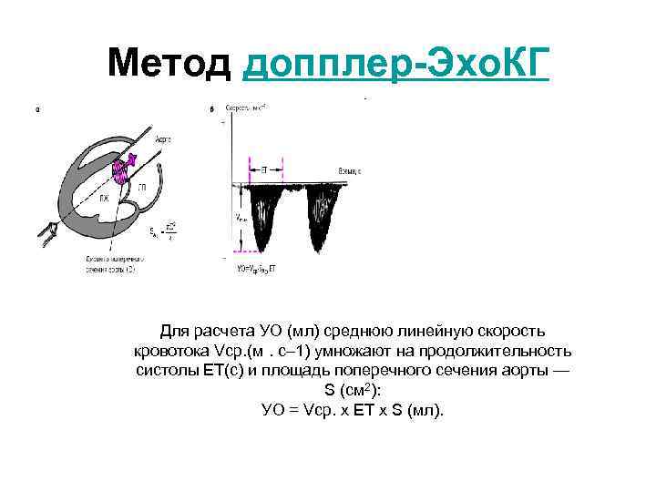 Метод допплер-Эхо. КГ Для расчета УО (мл) среднюю линейную скорость кровотока Vср. (м. с–