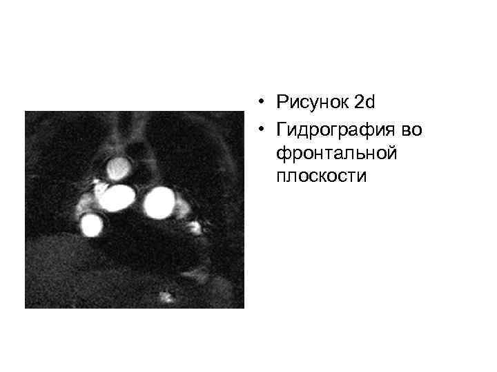  • Рисунок 2 d • Гидрография во фронтальной плоскости 