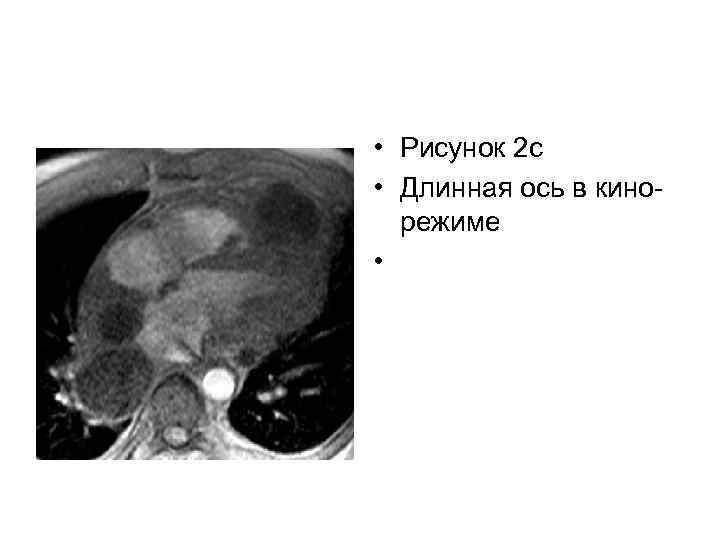  • Рисунок 2 c • Длинная ось в кинорежиме • 