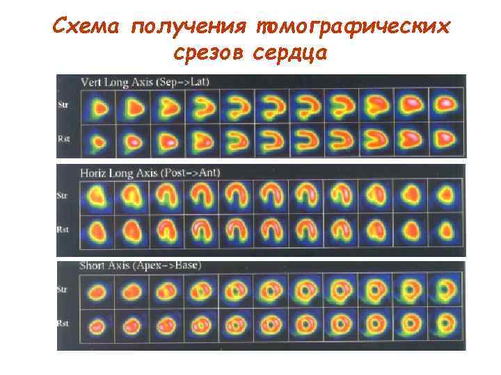 Схема получения томографических срезов сердца 