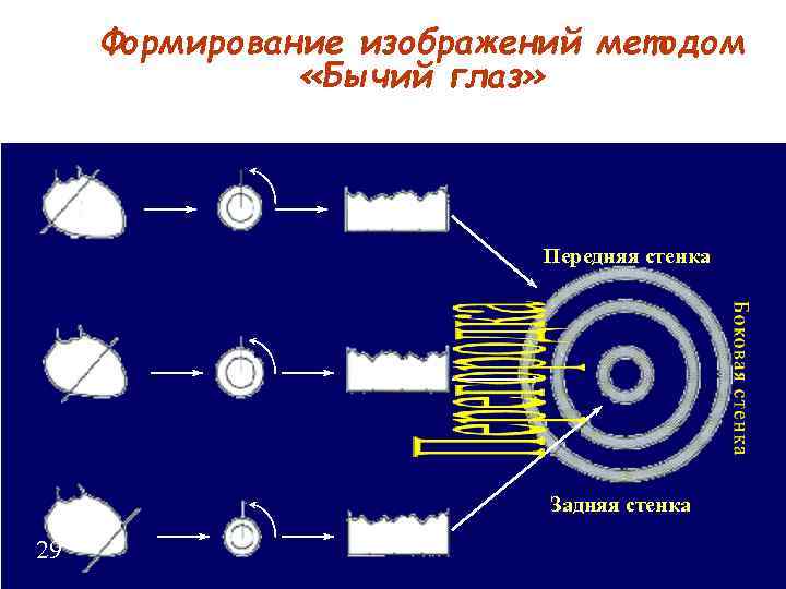 Формирование изображений методом «Бычий глаз» Передняя стенка Задняя стенка 29 