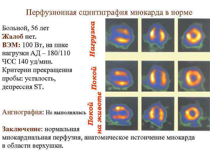 Радионуклидная диагностика презентация