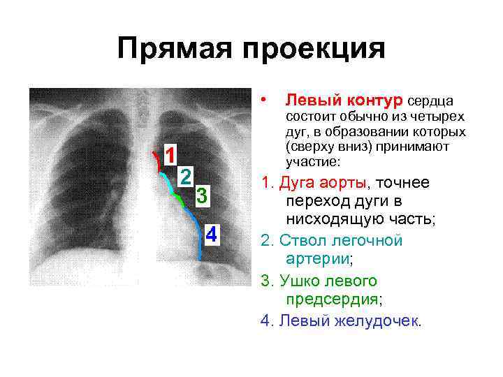 Прямая проекция • Левый контур сердца состоит обычно из четырех дуг, в образовании которых