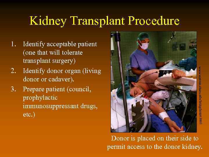 Kidney Transplant Procedure www. viscom. ohiou. edu/kring/home. html 1. Identify acceptable patient (one that