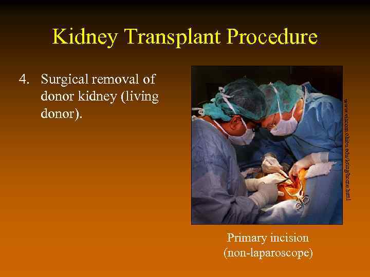 Kidney Transplant Procedure www. viscom. ohiou. edu/kring/home. html 4. Surgical removal of donor kidney