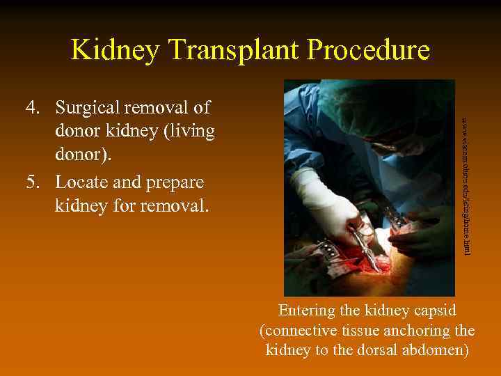 Kidney Transplant Procedure www. viscom. ohiou. edu/kring/home. html 4. Surgical removal of donor kidney