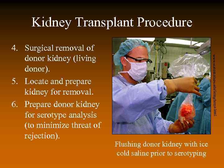 Kidney Transplant Procedure www. viscom. ohiou. edu/kring/home. html 4. Surgical removal of donor kidney