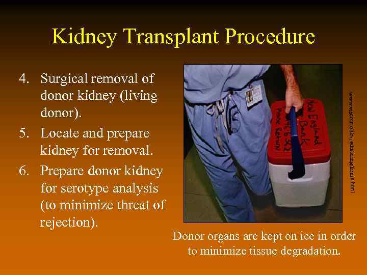 Kidney Transplant Procedure www. viscom. ohiou. edu/kring/home. html 4. Surgical removal of donor kidney