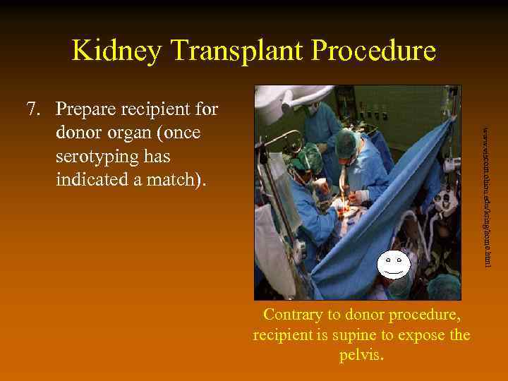 Kidney Transplant Procedure www. viscom. ohiou. edu/kring/home. html 7. Prepare recipient for donor organ