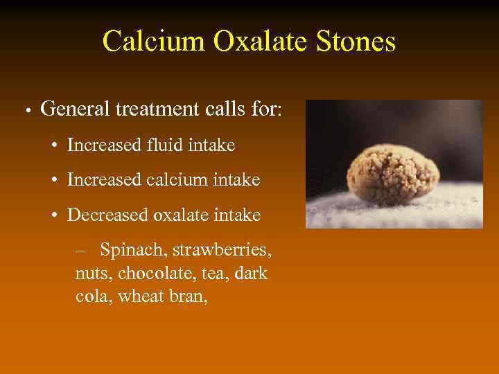 Calcium Oxalate Stones • General treatment calls for: • Increased fluid intake • Increased