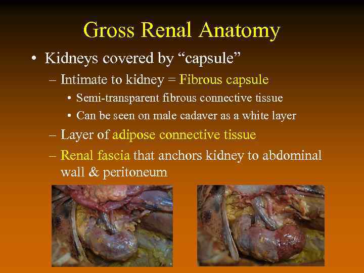 Gross Renal Anatomy • Kidneys covered by “capsule” – Intimate to kidney = Fibrous