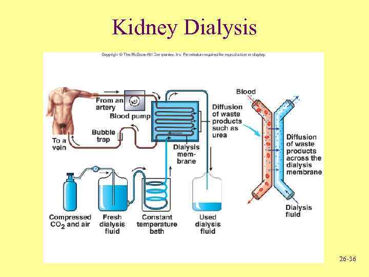 Kidney Dialysis 26 -36 