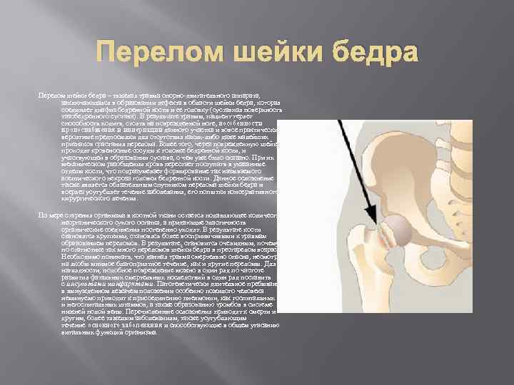 Перелом шейки бедра – тяжелая травма опорно-двигательного аппарата, заключающаяся в образовании дефекта в области