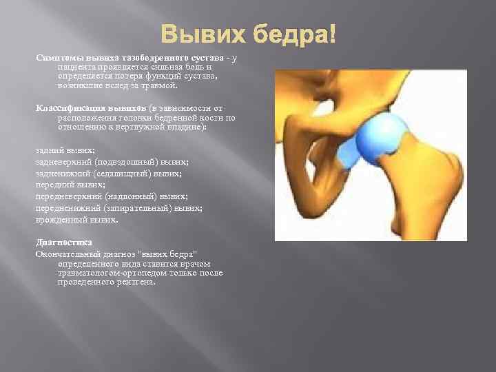 Вывих бедра Симптомы вывиха тазобедренного сустава - у пациента проявляется сильная боль и определяется