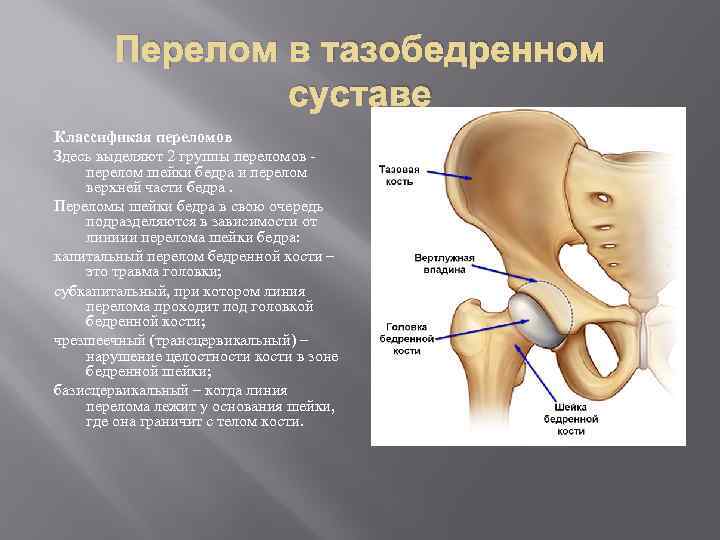 Перелом в тазобедренном суставе Классификая переломов Здесь выделяют 2 группы переломов - перелом шейки