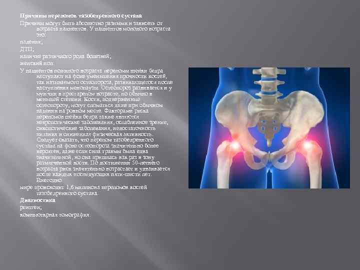 Причины переломов тазобедренного сустава Причины могут быть абсолютно разными и зависеть от возраста пациентов.