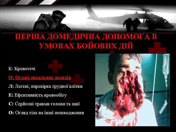 ПЕРША ДОМЕДИЧНА ДОПОМОГА В УМОВАХ БОЙОВИХ ДІЙ К: Кровотечі О: Огляд дихальних шляхів Л: