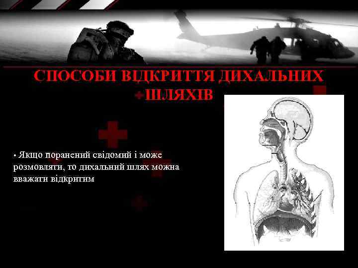 СПОСОБИ ВІДКРИТТЯ ДИХАЛЬНИХ ШЛЯХІВ Якщо поранений свідомий і може розмовляти, то дихальний шлях можна