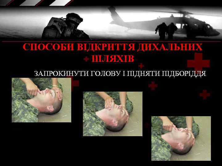 СПОСОБИ ВІДКРИТТЯ ДИХАЛЬНИХ ШЛЯХІВ ЗАПРОКИНУТИ ГОЛОВУ І ПІДНЯТИ ПІДБОРІДДЯ 