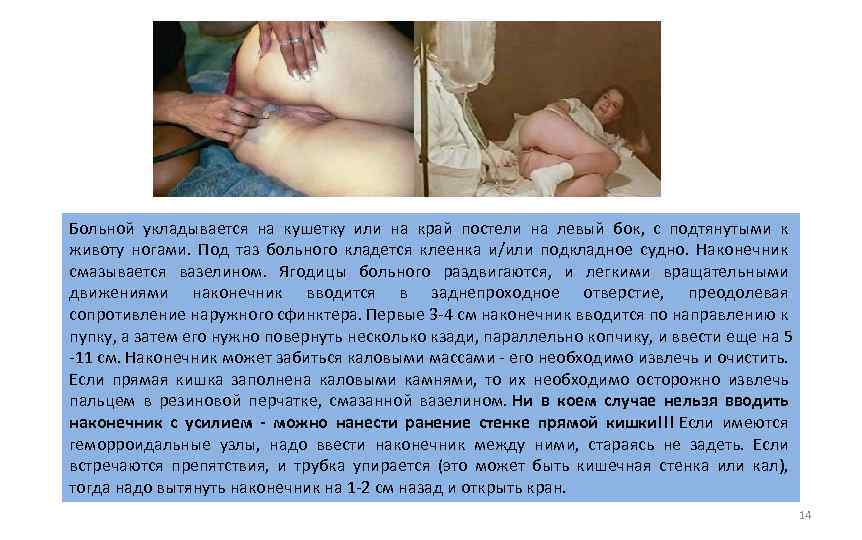 Больной укладывается на кушетку или на край постели на левый бок, с подтянутыми к