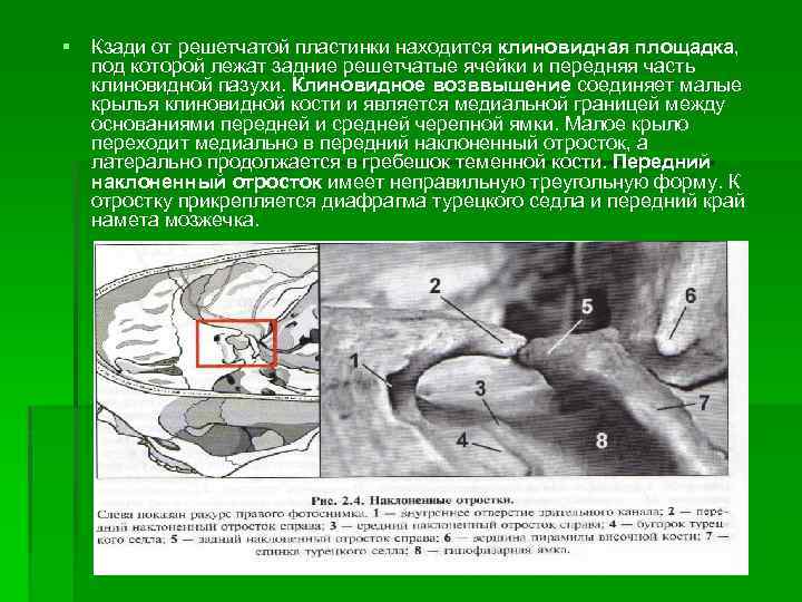§ Кзади от решетчатой пластинки находится клиновидная площадка, под которой лежат задние решетчатые ячейки