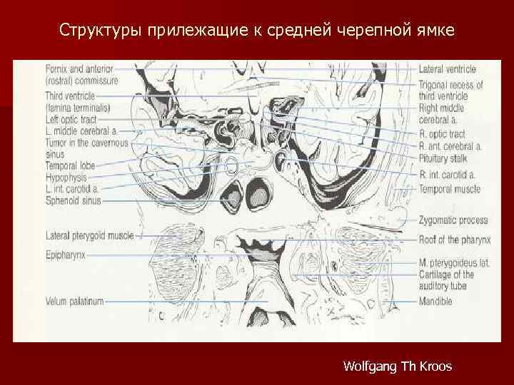 Структуры прилежащие к средней черепной ямке Wolfgang Th Kroos 