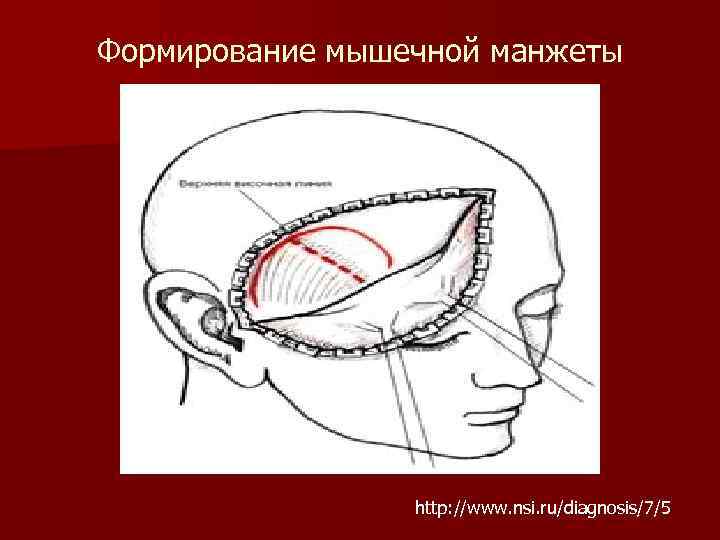 Формирование мышечной манжеты http: //www. nsi. ru/diagnosis/7/5 