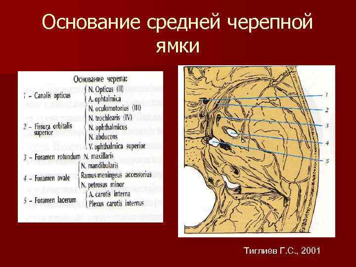 Основание средней черепной ямки Тиглиев Г. С. , 2001 