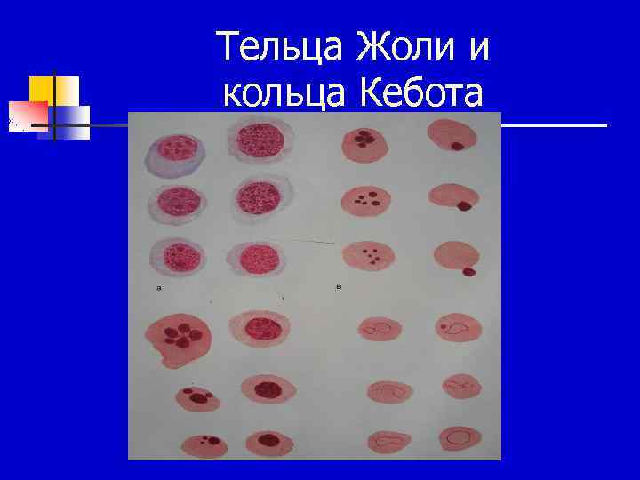 Тельца Жоли и кольца Кебота 