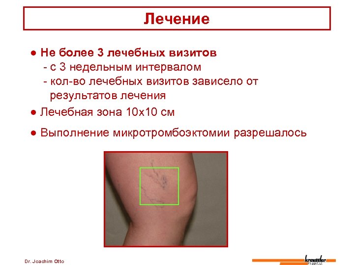 Лечение ● Не более 3 лечебных визитов - с 3 недельным интервалом - кол-во