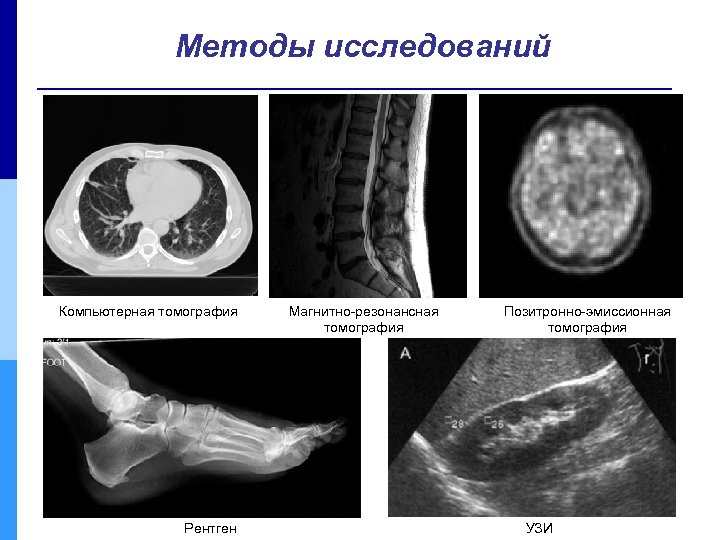 Мрт или узи. Кт методы исследования. Методы исследования компьютерной томографии. Методы УЗИ рентген. Методики кт исследования.