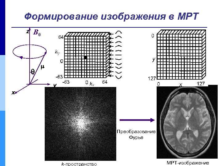 Фурье 2 кожно. Формирование мрт изображения. Преобразование Фурье. Принцип формирования изображения мрт. Пространство Фурье.