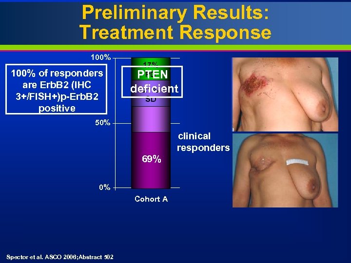 Preliminary Results: Treatment Response 100% of responders are Erb. B 2 (IHC 3+/FISH+)p-Erb. B