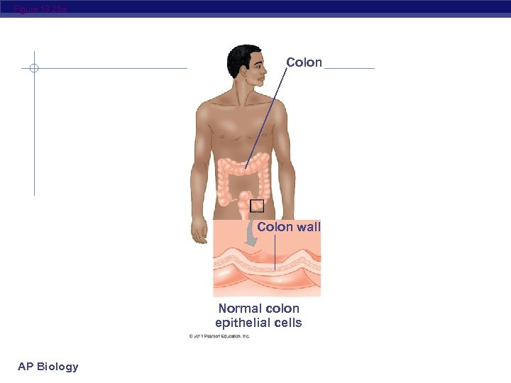Figure 18. 25 a Colon wall Normal colon epithelial cells AP Biology 