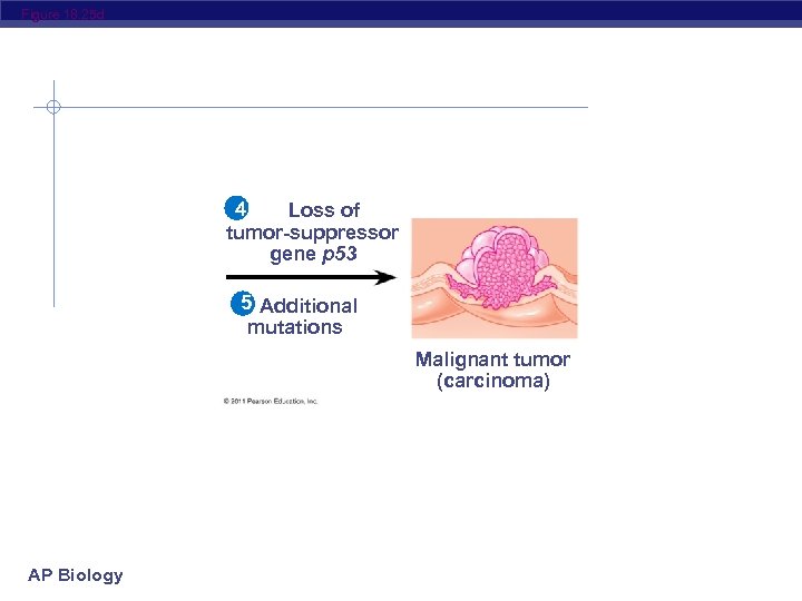 Figure 18. 25 d 4 Loss of tumor-suppressor gene p 53 5 Additional mutations