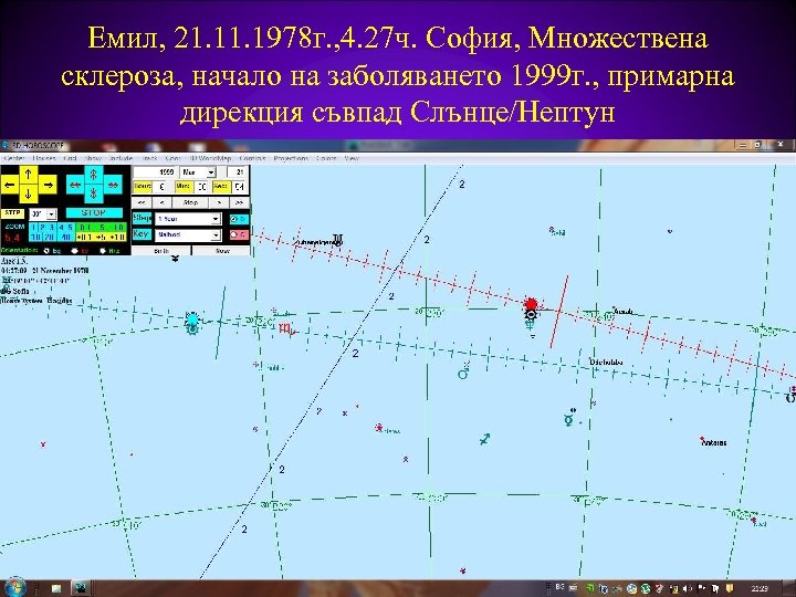Емил, 21. 1978 г. , 4. 27 ч. София, Множествена склероза, начало на заболяването