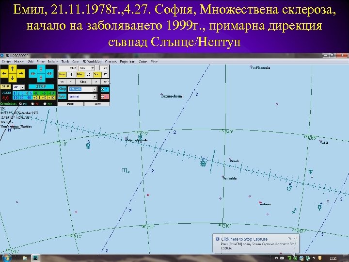 Емил, 21. 1978 г. , 4. 27. София, Множествена склероза, начало на заболяването 1999
