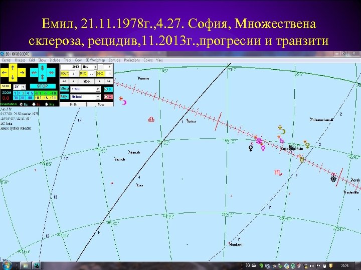 Емил, 21. 1978 г. , 4. 27. София, Множествена склероза, рецидив, 11. 2013 г.