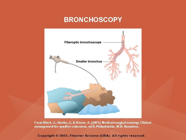 BRONCHOSCOPY From Black, J. , Hawks, J. , & Keene, A. (2001). Medical-surgical nursing: