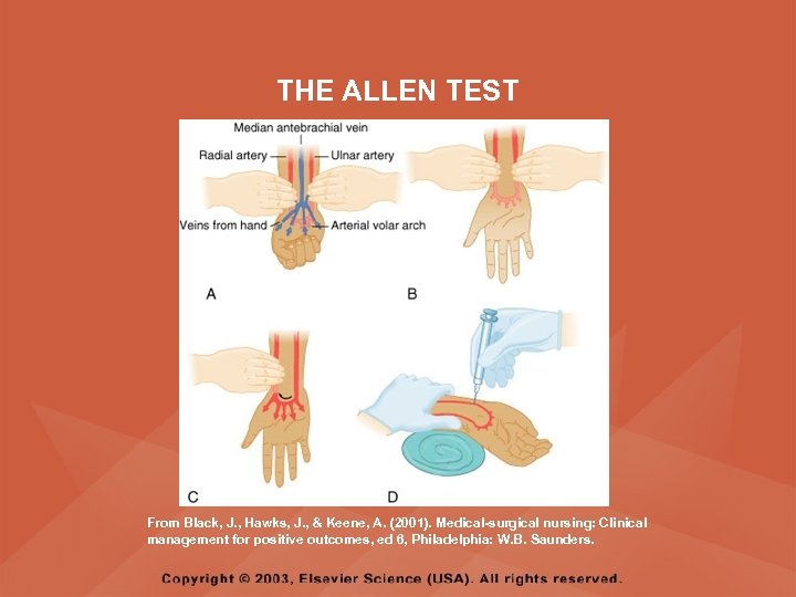 THE ALLEN TEST From Black, J. , Hawks, J. , & Keene, A. (2001).