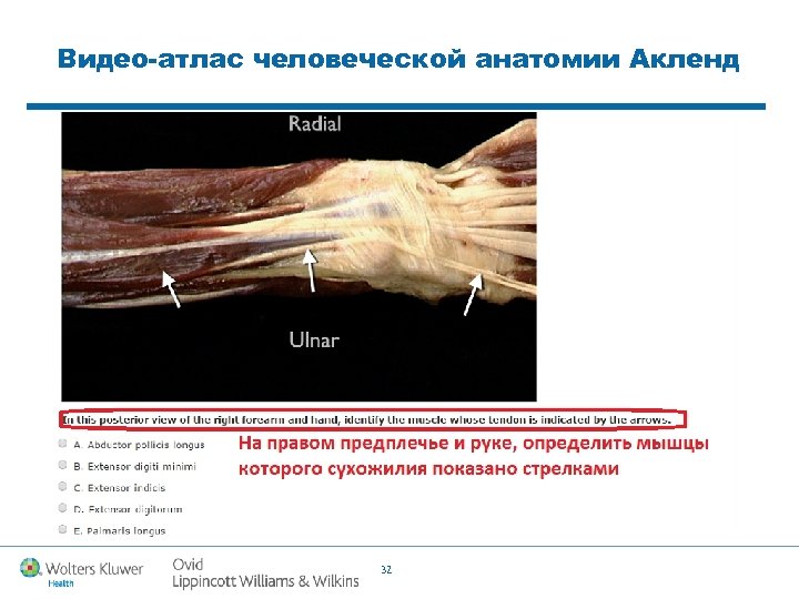 Видео-атлас человеческой анатомии Акленд 32 
