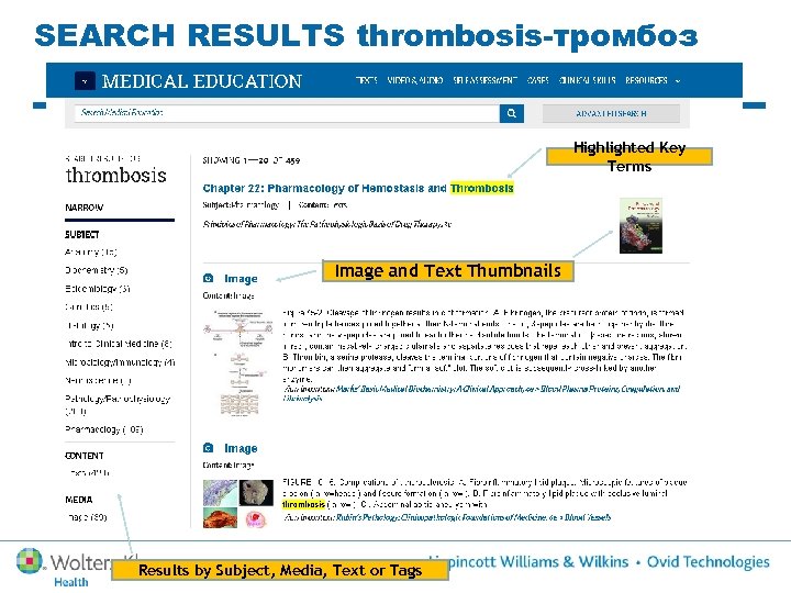 SEARCH RESULTS thrombosis-тромбоз Highlighted Key Terms Image and Text Thumbnails 40 Results by Subject,