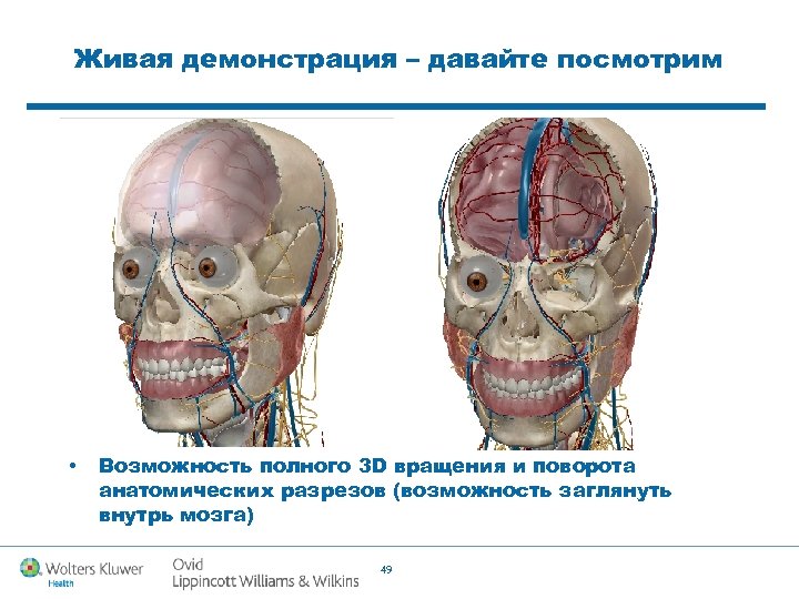 Живая демонстрация – давайте посмотрим • Возможность полного 3 D вращения и поворота анатомических