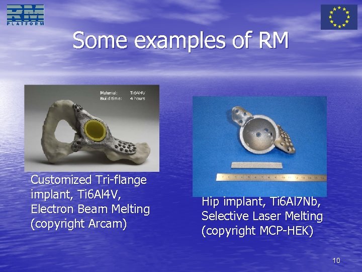 Some examples of RM Customized Tri-flange implant, Ti 6 Al 4 V, Electron Beam