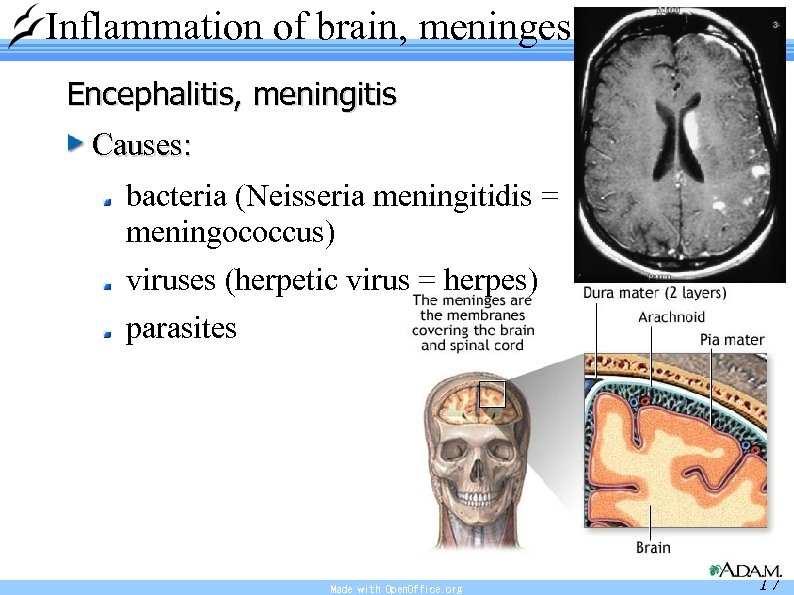 Inflammation of brain, meninges Encephalitis, meningitis Causes: bacteria (Neisseria meningitidis = meningococcus) viruses (herpetic