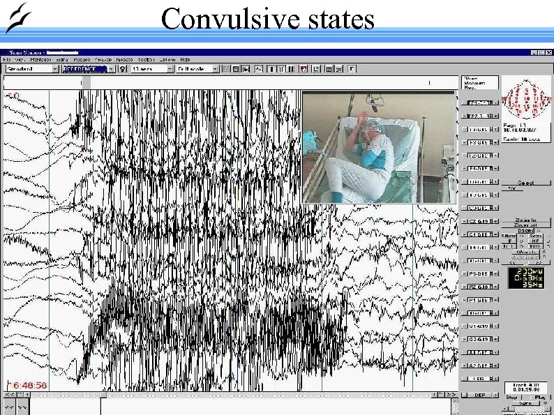 Convulsive states Made with Open. Office. org 26 
